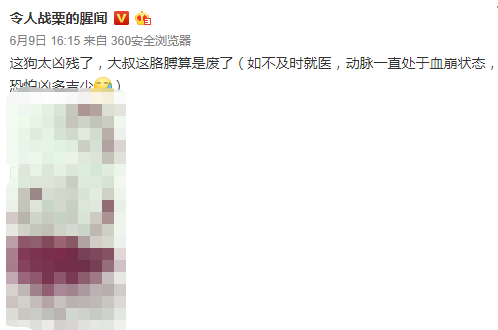 狗攻击行为的背后，往往是一连串心酸的往事-1.png