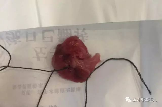 引发呼吸困难的软腭过长症，你的法斗有这问题吗？-7.jpeg