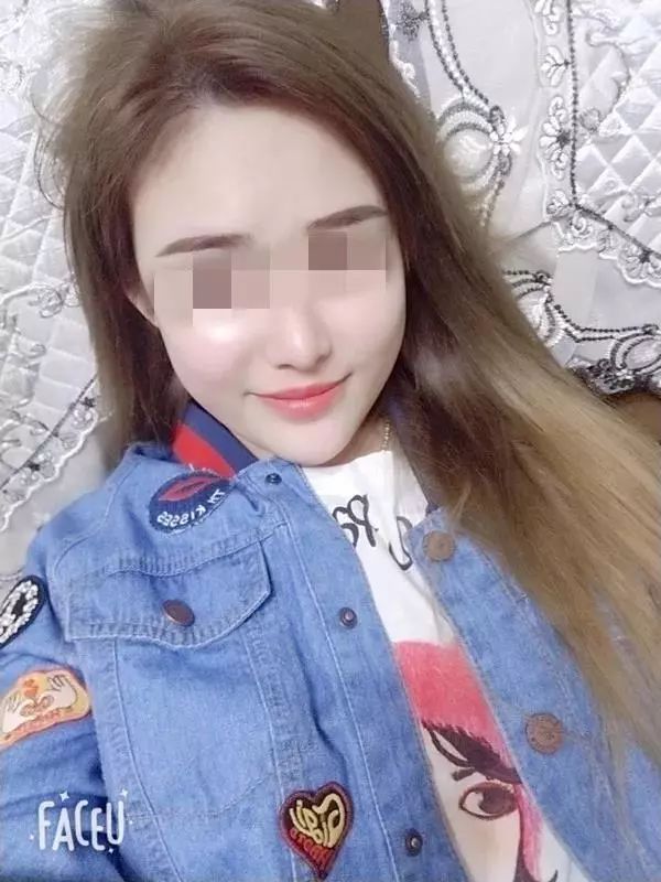 女孩逗狗惨遭毁容 | “人类，你的热情吓坏了我”-1.jpeg