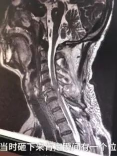 出差的主人终于回家了，狗狗开心成“龙卷风”！-4.jpeg