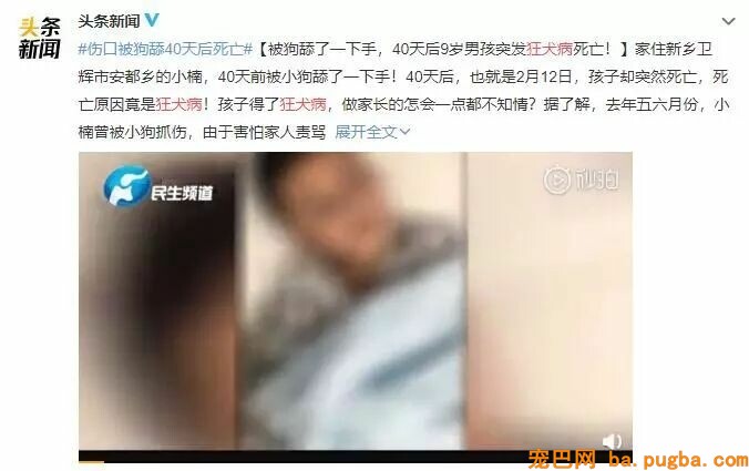 男孩被狗舔伤口40天后狂犬病死亡？专家：跟这只狗不妨！-1.jpeg