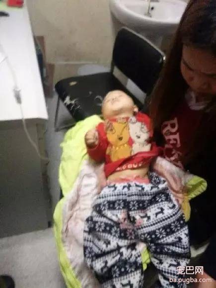 1岁男童的终身性福被家里的狗狗咬掉了…！隔着屏都觉得疼-2.jpeg