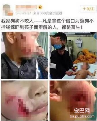我的狗狗不咬人” 这样就可以不牵牵引绳了嘛？-1.jpeg