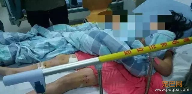 9岁女孩遭两宠物狗疯咬，竟因她身上有这种东西...-1.jpeg