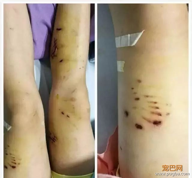 9岁女孩遭两宠物狗疯咬，竟因她身上有这种东西...-3.jpeg