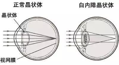狗狗的眼睛愈发浑浊？小心得上白内障-2.jpeg