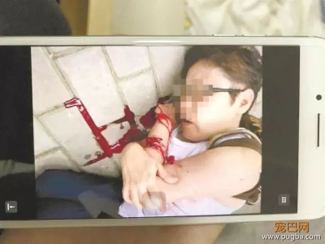小狗咬伤人，这个小区的做法也太暖了-1.jpeg