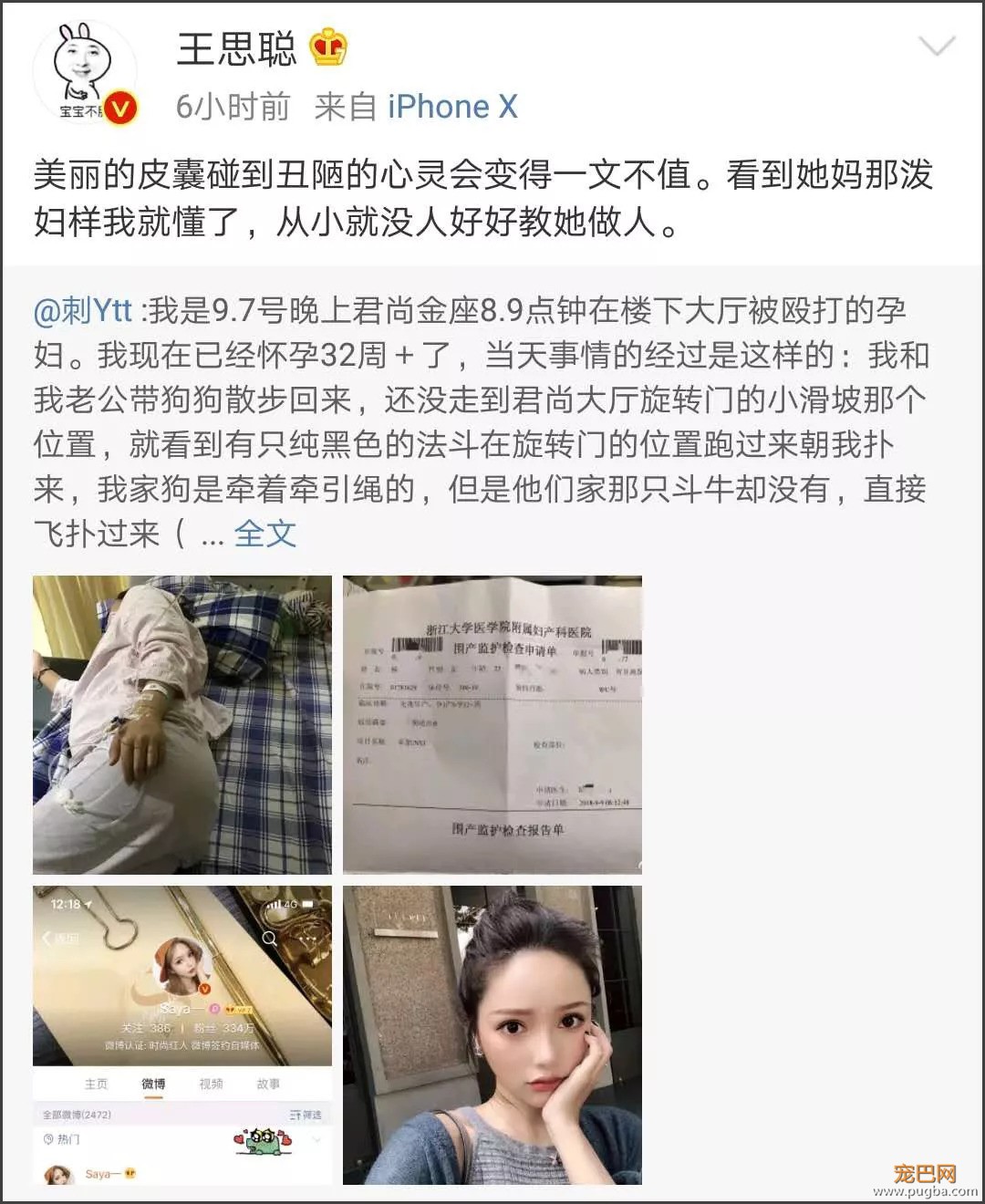 网红遛狗不牵绳致孕妇早产，长得丑就可以没素质？-2.jpeg
