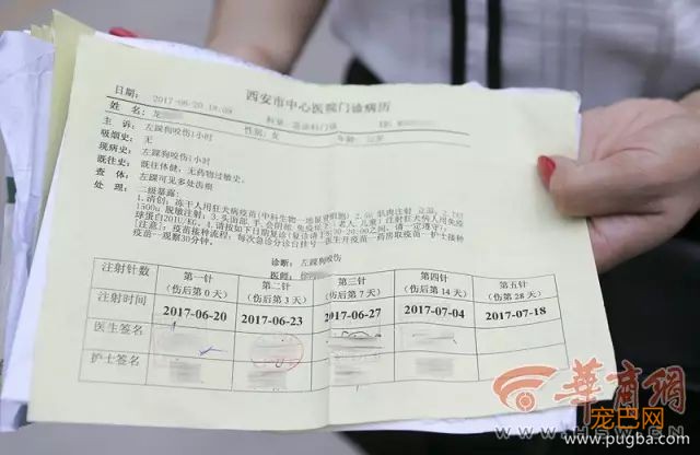 打了4针狂犬疫苗后仍病发身亡！天热狗狗也烦躁，这些一定要注意！-3.jpeg